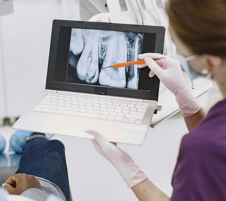 A dental professional wearing gloves points to a dental X-ray on a laptop screen while explaining it to a patient seated nearby. The setting appears to be a modern dental clinic.